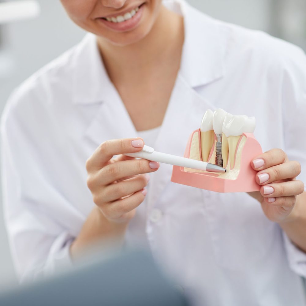 dentist-explaining-tooth-implantation-process-W4PZYA8.jpg